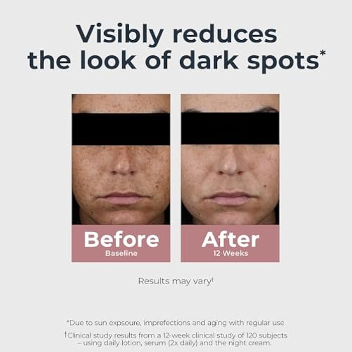 Eucerin Radiant Tone Night Cream, Dark Spot Corrector with Thiamidol, Night Moisturizer for Face Helps Visibly Reduce the Look of Dark Spots, All Skin Types, Holiday Gifts for Self Care, 1.7 Oz Bottle - Image 3