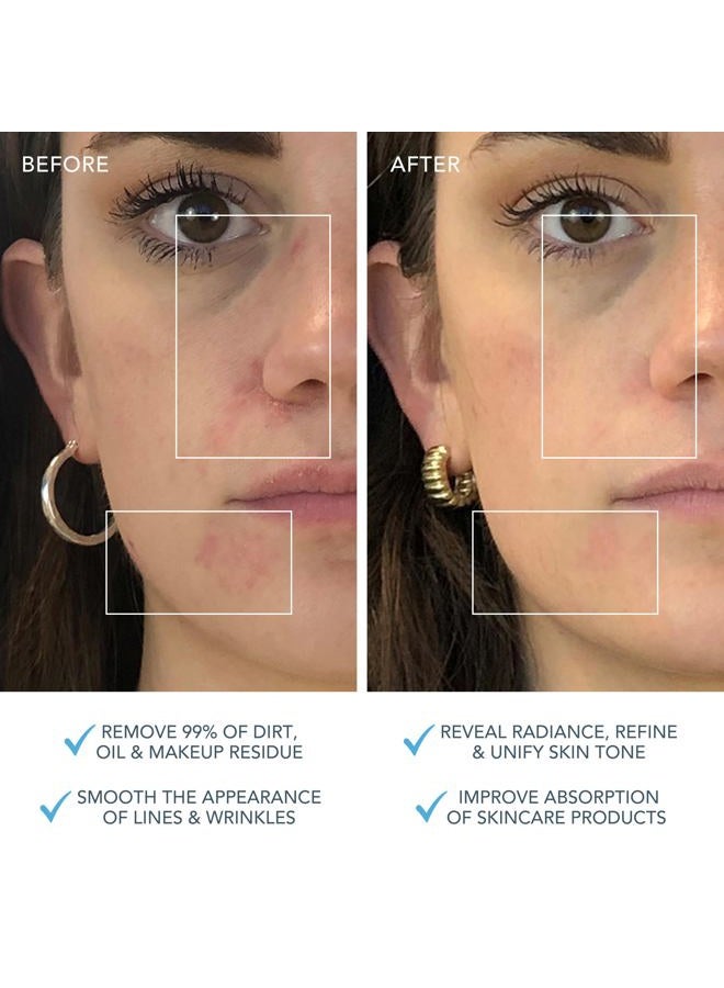 FOREO LUNA 3 Facial Cleansing Brush | Combination skin | Anti Aging Face Massager | Enhances Absorption of Facial Skin Care Products|For Clean&Healthy Face Care|Simple&Easy|Waterproof|Battery Powered - Image 4