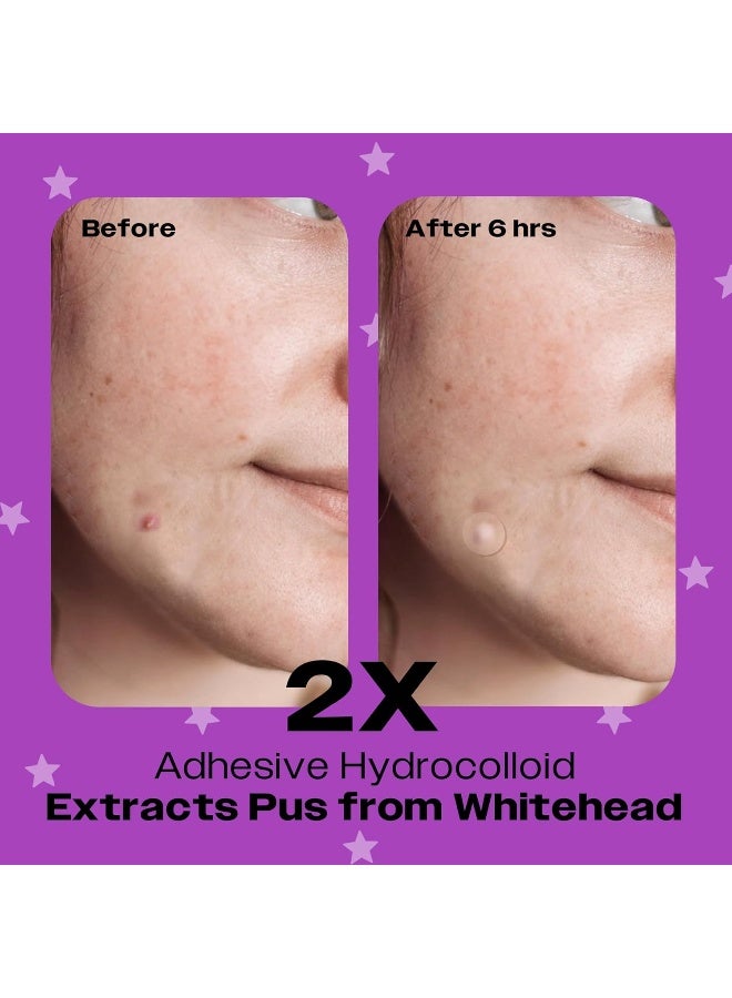 AVARELLE Acne Pimple Patch/Spot Patch - Image 3