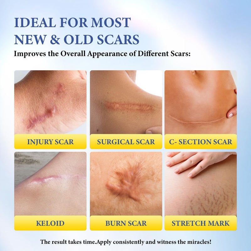 BORMSI Scar Cream,SPF 30 Suncreen & PM Silicone Intensive Overnight Scar Gel Reduces the Appearance of Scars from Surgical Scars,Stretch Marks,Keloid, 2 Tube,1.76 oz/Tube - Image 3