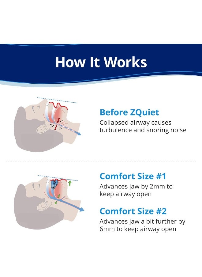 ZQuiet, Anti-Snoring Mouthpiece, Starter Pack with 2 Sizes, Living Hinge & Open Front Design for Comfort & Easy Breathing, Clear, Mint - pzsku/Z91B86C99885457AFADA0Z/45/_/1741000264/fb6e2dc0-11e3-4add-a4f1-b764923c160f