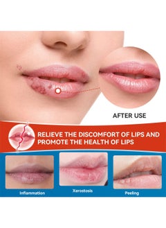 Sumifun Cheilitis Cream, Deep Moisturizing Repairing Anti Drying Healing Lip Balm, Lip Repair Stick Lip Care for Dry Cracked Lips, Fade Lines, Repair Cheilitis, Restore Lip Protection 20G  - Image 3