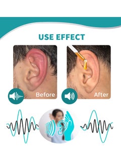 EELHOE Ear Ringing Treatment Oil for Relieve Tinnitus and Ear Itching  - Image 4