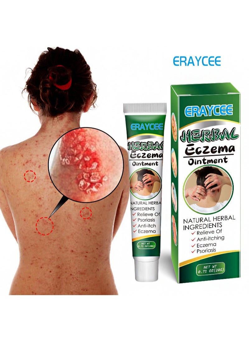 2 Pieces Herbal Eczema Ointment,Medical Ointment For Dermatitis, Antibacterial And Anti-Itching, Psoriasis Treatment