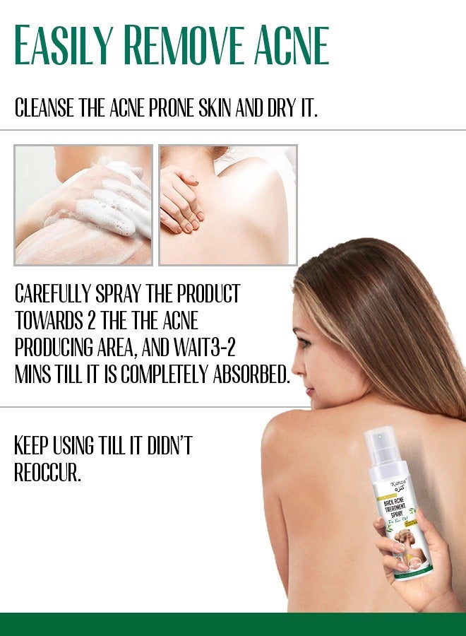 Kanza بخاخ علاج حب الشباب في الظهر 120 مل 2% حمض الساليسيليك علاج حب الشباب في الجسم مع تركيبة عشبية بخاخ حب الشباب في الظهر محلول زيت شجرة الشاي بخاخ مهدئ ومرطب للبشرة الحساسة - Image 4