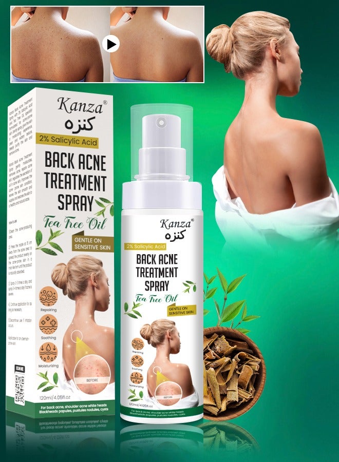 Kanza بخاخ علاج حب الشباب في الظهر 120 مل 2% حمض الساليسيليك علاج حب الشباب في الجسم مع تركيبة عشبية بخاخ حب الشباب في الظهر محلول زيت شجرة الشاي بخاخ مهدئ ومرطب للبشرة الحساسة - Image 1