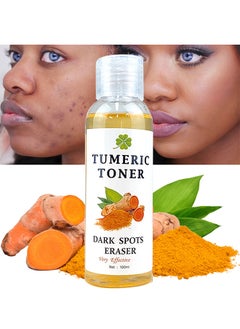 MOOYAM Turmeric Dark Spot Corrector Toner 100ML Facial Toner For Acne Prone Skin Dark Spot Remover For Face Hydrating Face Toner For Women Treatment  - Image 1