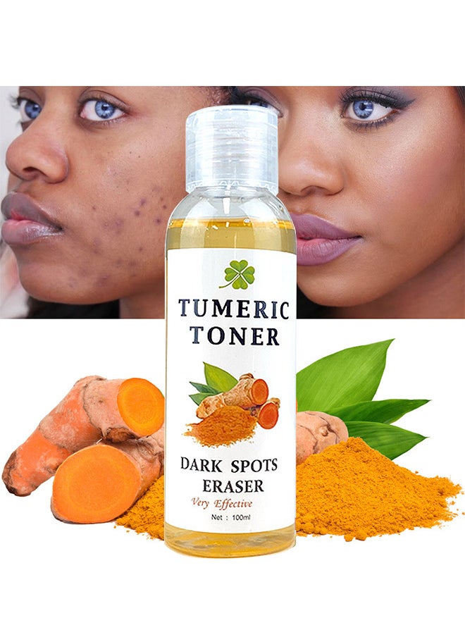 MOOYAM Turmeric Dark Spot Corrector Toner 100ML Facial Toner For Acne Prone Skin Dark Spot Remover For Face Hydrating Face Toner For Women Treatment  - Image 1