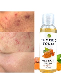 MOOYAM Turmeric Dark Spot Corrector Toner 100ML Facial Toner For Acne Prone Skin Dark Spot Remover For Face Hydrating Face Toner For Women Treatment  - Image 2