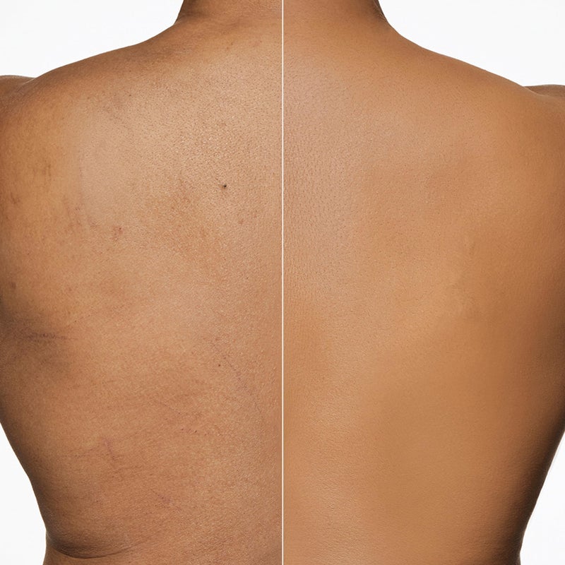 Dermablend Leg and Body Makeup Foundation with SPF 25, 45W Tan Honey, 3.4 Fl. Oz. - Image 2