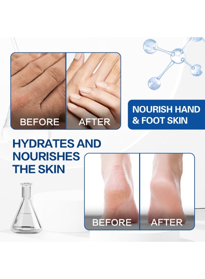 OUKEYA Hand and Foot Cream with 42% Urea Cream + 2% Salicylic Acid, Moisturizing and Exfoliating, Nourishing Dry and Cracked Hands and Feet 85g - Image 4