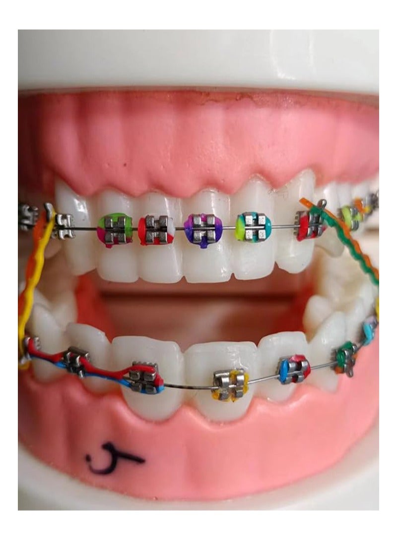 هالونهي 20 عصا (320 قطعة) ربطات تقويم الأسنان ثنائية اللون، ربطات تقويم الأسنان متعددة الألوان، أربطة مطاطية مرنة على شكل حلقة دائرية، أكثر متعة للأطفال والمرضى (أزرق ووردي) - Image 5