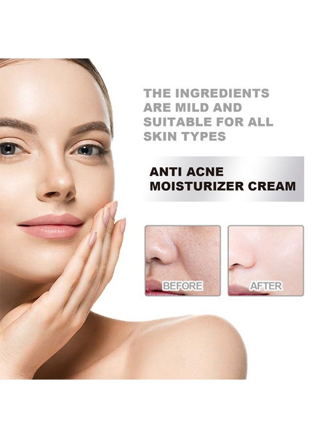 إيلهو كريم مرطب مضاد لحب الشباب ، كريم مرطب للوجه للبشرة المعرضة لحب الشباب ، كريم للوجه للتحكم في حب الشباب بحمض الهيالورونيك والنياسيناميد ، كريم مزيل حب الشباب للترطيب ، العناية بالبشرة الحساسة 50 جرام - Image 5