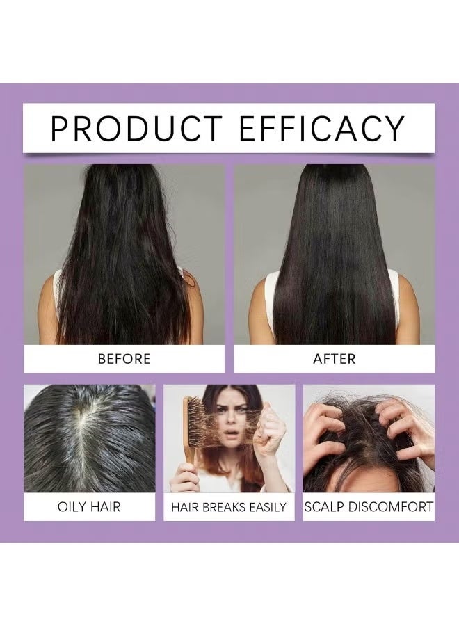 HOEGOA 5% Minoxidil Foam for Women Hair Growth Foam, Rosemary Hair Care Suitable for Hair Thinning Receding Hairline 100ml/3.38fl oz - Image 2