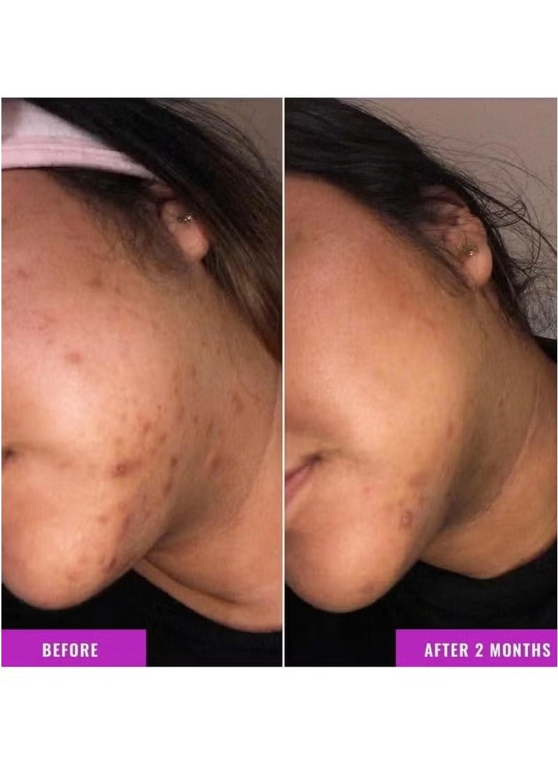 Good Molecules Discoloration Correcting Serum - Image 3