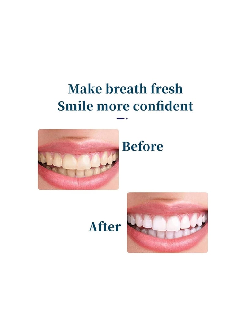 Generic - Yunpso Toothpaste, Yunpso - Triple Whitening Niacinamide Whitening Toothpaste, Niacinamide Whitening Toothpaste, Fresh Breath Toothpaste for Adults (3pcs) - Image 1