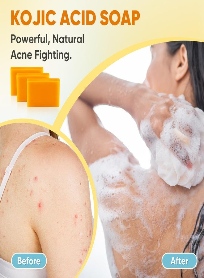 Treeroot 5 Pack Kojic Acid Soap, 80g Kojic Acid and Turmeric Soap Bar, Natural Potent Moisturizing Ingredient, Contains Kojic Acid, Turmeric, Vitamin C, Shea Butter, Lemon Oil, Retinol - Image 4