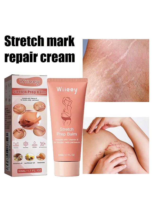 wiieey Stretch Marks Remover Essential Care Cream 50ml - 100% Natural Pure Plant Extract - Improve the Appearance of Scars, Stretch Marks and Skin Tone - Image 2