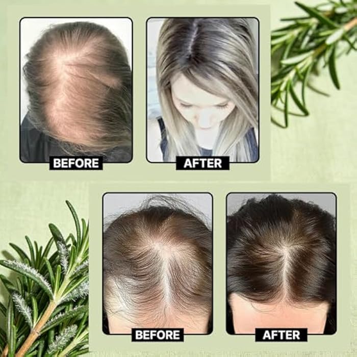 NUSQO Organic Rosemary Hair Growth Shampoo with Hydrolyzed Keratin - Anti-Hair Loss, Thickening & Strengthening Shampoo for Women and Men (Pack of 3) - Image 5