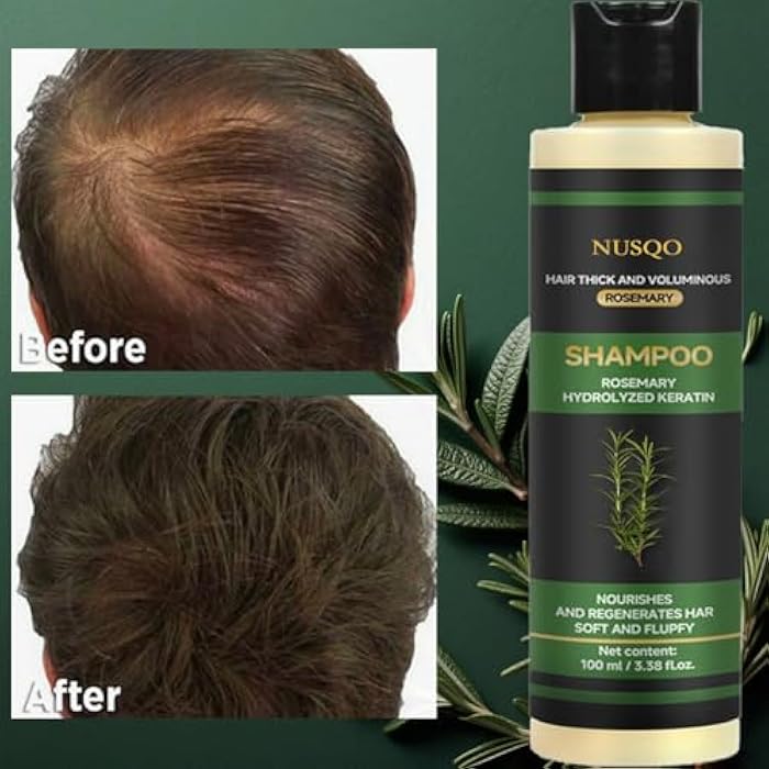 NUSQO Organic Rosemary Hair Growth Shampoo with Hydrolyzed Keratin - Anti-Hair Loss, Thickening & Strengthening Shampoo for Women and Men (Pack of 3) - Image 2