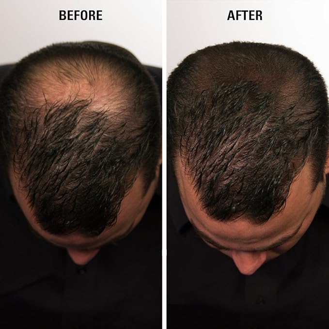 Infinity Hair Fibers Keratin Hair Loss Concealer Women and Men Light Brown 14 gram