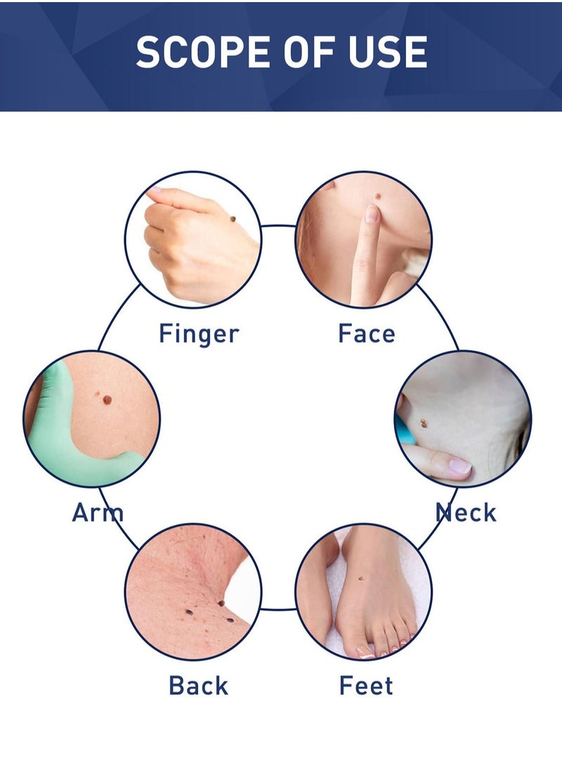 Skin Tag Remover Easy to Use Fast Effective Painless Natural Safe Suitable for All Skin Types