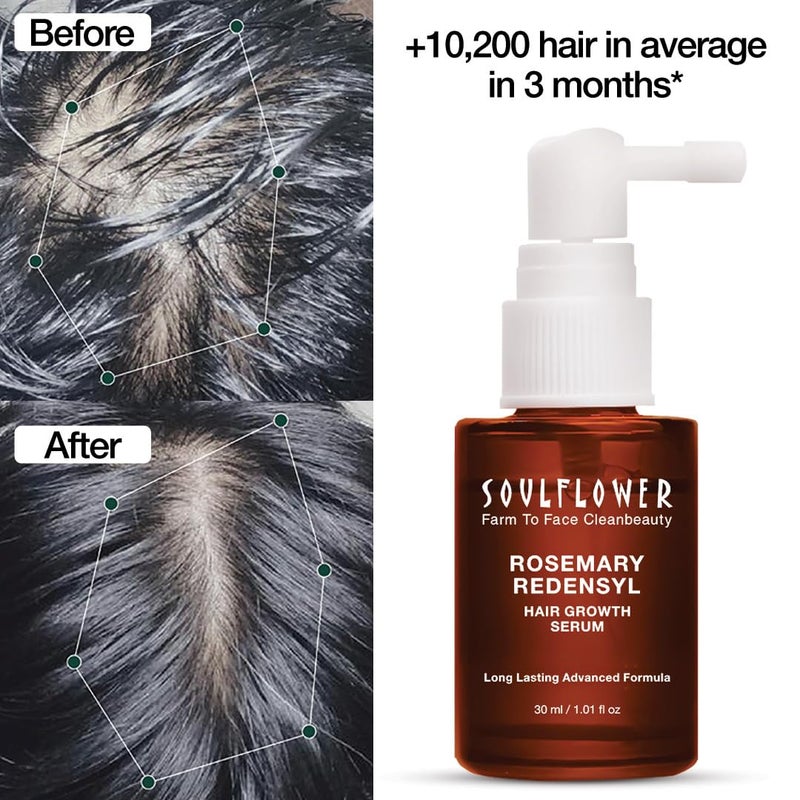 Soulflower Soulflower Hair Growth Redensyl Tetragain SerumRosemary Oil3 Redensyl4 AnagainCaffeineMelanograyBiotinRice WaterAnti Hair fallClinically Tested on Real peopleUnisexPack of 3 30 ml each - Image 3