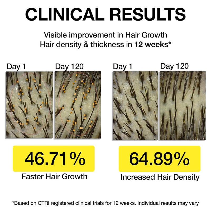 Soulflower Soulflower Hair Growth Redensyl Tetragain SerumRosemary Oil3 Redensyl4 AnagainCaffeineMelanograyBiotinRice WaterAnti Hair fallClinically Tested on Real peopleUnisexPack of 3 30 ml each - Image 2