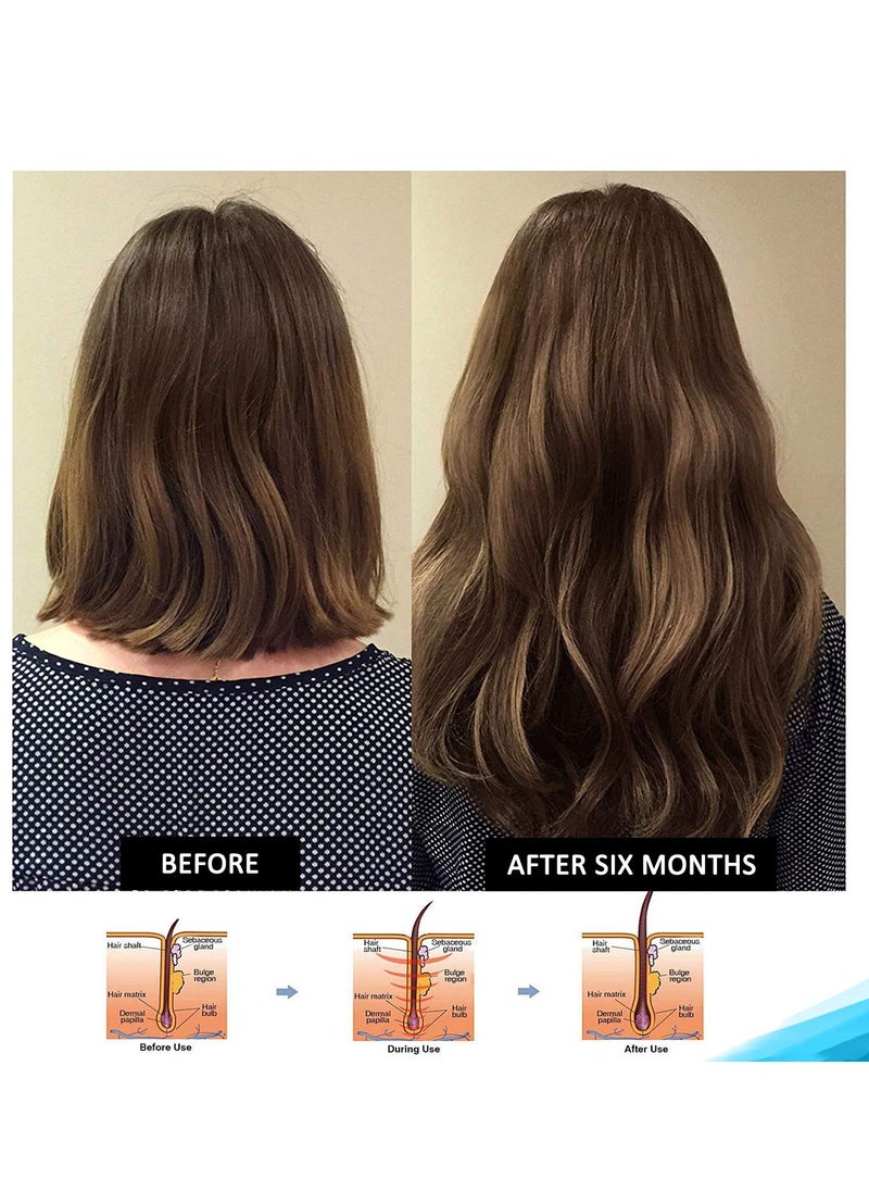 Pronexa - Hairgenics Pronexa Clinical Strength Hair Growth & Regrowth Therapy Hair Loss Shampoo With Biotin, Collagen, and DHT Blockers for Thinning Hair, 8 fl. oz. - Image 1
