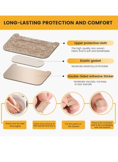 General 60Pcs Breathable Ingrown Toenail Corrector Patches and 50Pcs Ingrown Toenail Stickers - Professional Ingrown Toe Nail Treatment Tape for Pain Relief and Correction  - Image 4