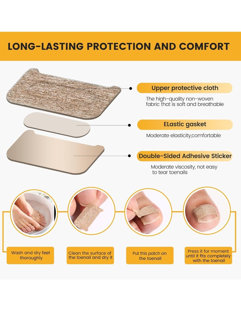 General - 60Pcs Breathable Ingrown Toenail Corrector Patches and 50Pcs Ingrown Toenail Stickers - Professional Ingrown Toe Nail Treatment Tape for Pain Relief and Correction - Image 1