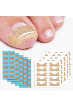 General 60Pcs Breathable Ingrown Toenail Corrector Patches and 50Pcs Ingrown Toenail Stickers - Professional Ingrown Toe Nail Treatment Tape for Pain Relief and Correction  - Image 1