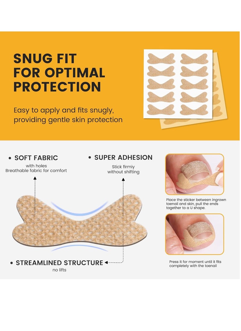 General - 60Pcs Breathable Ingrown Toenail Corrector Patches and 50Pcs Ingrown Toenail Stickers - Professional Ingrown Toe Nail Treatment Tape for Pain Relief and Correction - Image 1