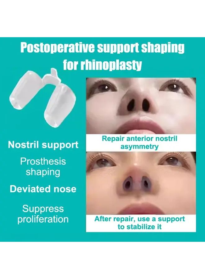 2Pcs Anti Snoring Nose Clip Nostril Dilator Ventilation Pad Bracket Ergonomic Design Reduces Snoring Improves Sleep Quality Comfortable Sleep Aid For Home Travel Men Women - Image 5