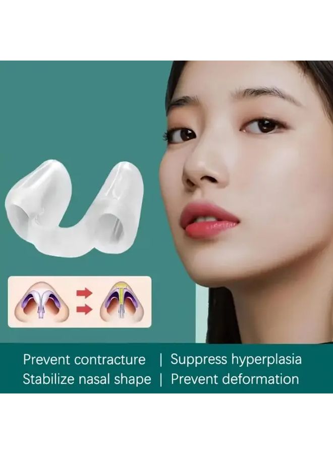 2Pcs Anti Snoring Nose Clip Nostril Dilator Ventilation Pad Bracket Ergonomic Design Reduces Snoring Improves Sleep Quality Comfortable Sleep Aid For Home Travel Men Women - Image 2