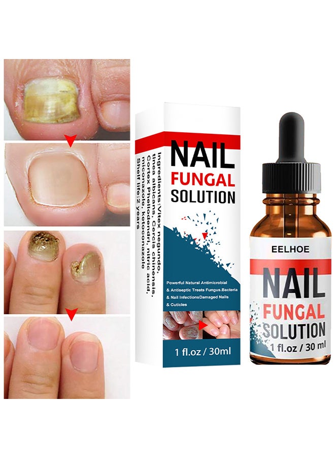إيلهو محلول فطري للأظافر ، علاج الأظافر الفطرية لأظافر أصابع القدم وأظافر الأصابع - محلول إصلاح للأظافر السميكة / المكسورة / المتغيرة اللون - يجدد أظافر القدم المتشققة التالفة 30 مل - Image 1