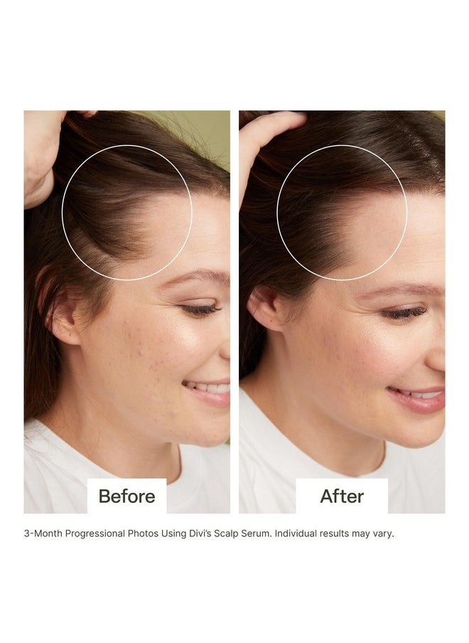 DiVi - Scalp Serum Revitalize And Detoxify Aids Against Hairthinning Nourishes Hair Follicles Detoxifies Product Buildup (30 Ml) - Image 1