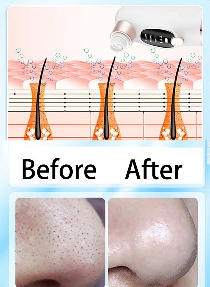 Blackhead Remover, Pore and Facial Vacuum Cleaner, USB Rechargeable Blue Light Cleaning Tools with 3 Modes and 6 Probes - Image 2