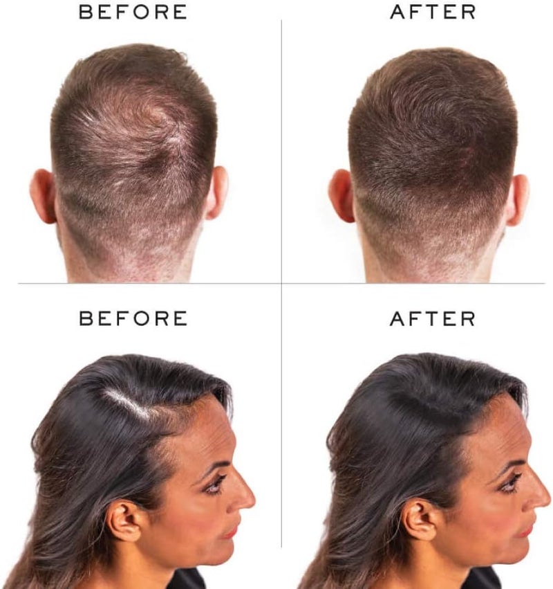 Nanogen Keratin Hair Thickening Fibres 30g - Black - 2 Month Supply for Thinning Hair - Image 4