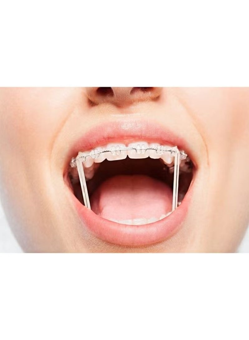 500 Pack Orthodontic Elastic Bungee Bands, 3.5 oz Heavy Duty Dental Rubber Leashes (1/4"，6.4mm) - Image 2