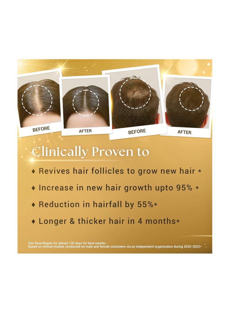 سيسا زيت أيورفيدا ريجين لإعادة ملء نمو الشعر مع 26 عشبة و6 زيوت عطرية يعزز نمو الشعر ويساعد على تقليل تساقط الشعر وتقوية الجذور، زيت شعر طبيعي للنساء والرجال، 100 مل - Image 3