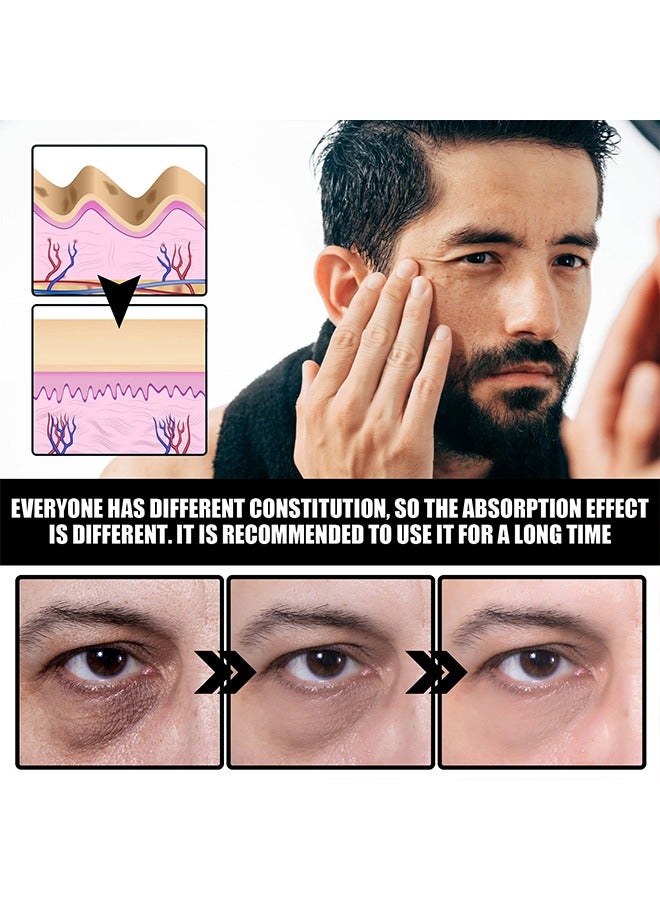 EELHOE Under Eye Cream Firming Eye Skin-Eye Cream For Dark Circles And Puffiness, Anti-aging Caffeine Eye Cream For Men, Brightens, Reduces Puffiness, Dark Circles, And Fine Lines, Eye Treatment for Men 7ml - Image 2