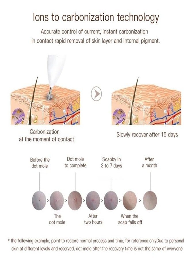 SWEETPEA� Mole Removal Plasma Pen with 9 strength levels for treating dark spots, freckles, warts, and speckles on the face - Image 4