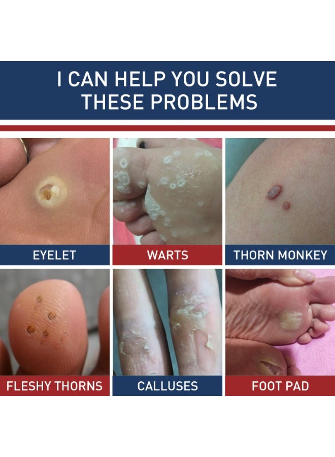 24PCS Foot Corn Removal Plaster, Natural Ingredients, Foot Care Expert, Calluses Plantar Treatment, Relief Pain From Calluses, Corns, Blisters, Heel Frictions - Image 5