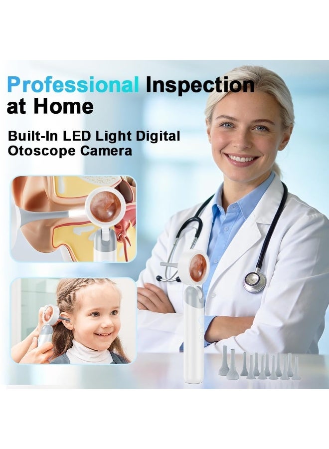 L LULONG 1080P HD Ear Endoscope with Screen – LED Ear Camera Cleaner Visual Ear Scope with Display Recording Otoscope for Adults Kids Portable - Image 2