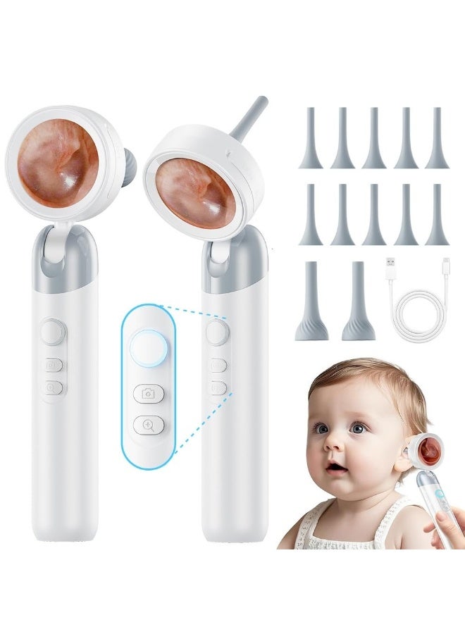 L LULONG 1080P HD Ear Endoscope with Screen – LED Ear Camera Cleaner Visual Ear Scope with Display Recording Otoscope for Adults Kids Portable - Image 1