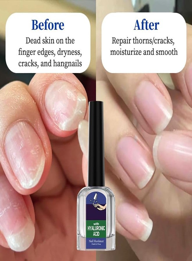 Oprtuisi Nail Care Cuticle Oil, 2-Pack Fast Absorbing Repair Serum for Cracked Cuticles, Suitable for Manicures and Home Care - Image 2