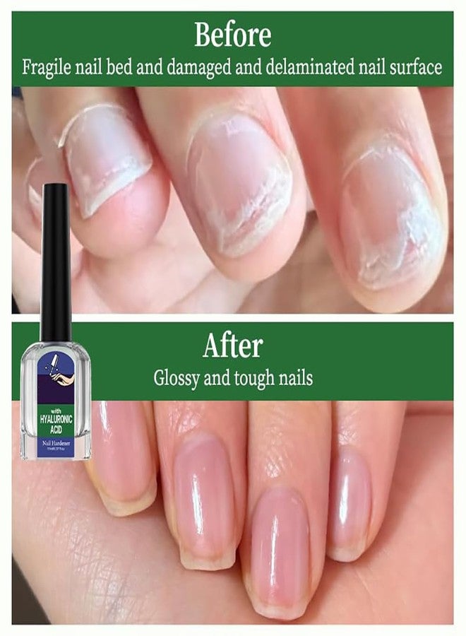 Oprtuisi Nail Care Cuticle Oil, 2-Pack Fast Absorbing Repair Serum for Cracked Cuticles, Suitable for Manicures and Home Care - Image 5