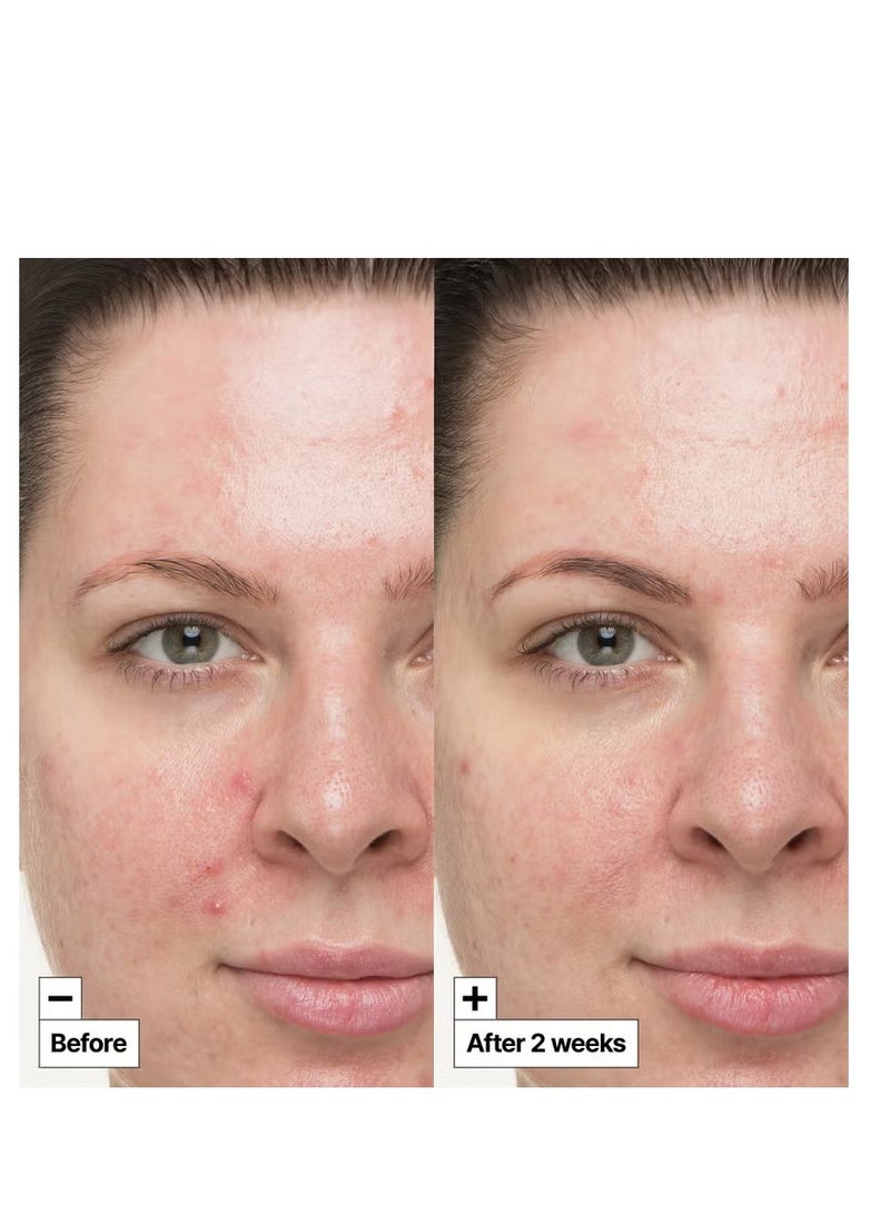 دي آر. جارت+ دكتور جارت+ سيكابير سو علاج مهدئ 30 مل - Image 3