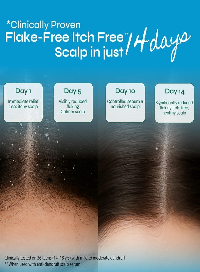 Tikitoro Teens Anti-dandruff Shampoo and Scalp Serum Combo | Cleanses Scalp and Fights Dandruff Causing Fungi | All Scalp Types | No Parabens & Sulphates (Age: 11+) (300ml x 1 and 100ml x 1) - Image 5